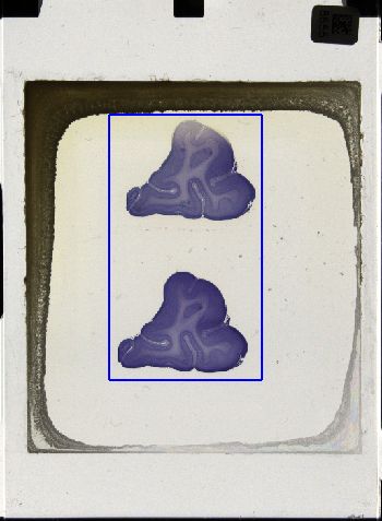 Media type: image; Special Collections 3043   shows specimen_part histological serial section;